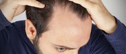 ریزش مو در مردان علت و درمان