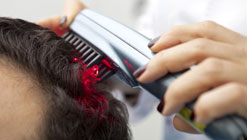 لیزرتراپی مو چیست؟