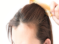  درمان ریزش موی عصبی 